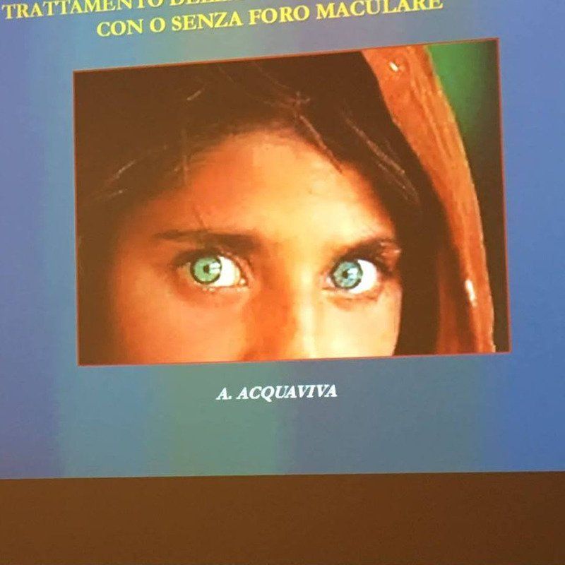 occhi di donna