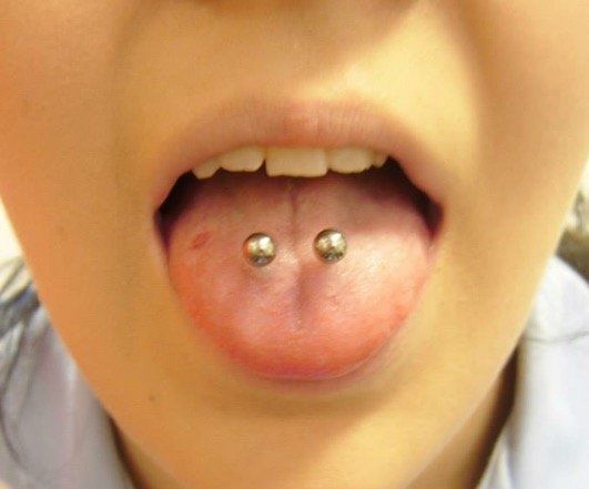 tongue piercing