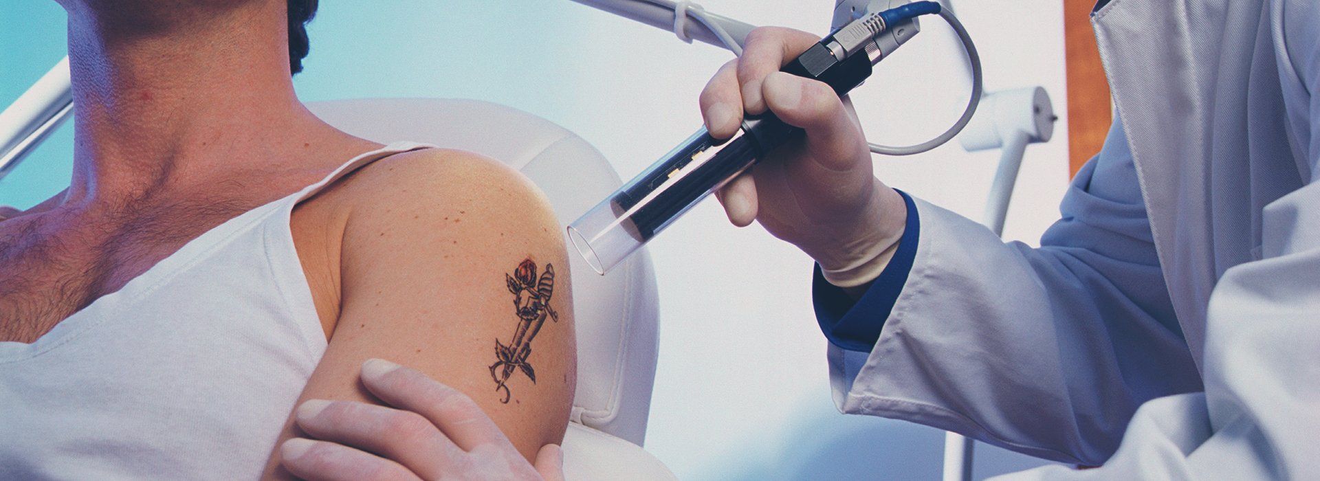 Tattoo removal