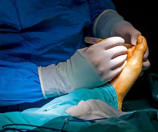 nail surgery