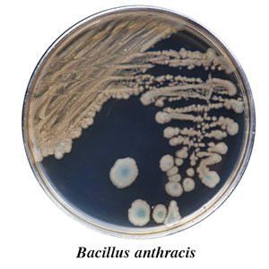 A petri dish with bacillus anthracis on it