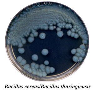 A plate of bacillus cereus and bacillus thuringiensis
