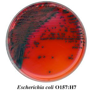 A plate of escherichia coli 0157 h7 on a white background