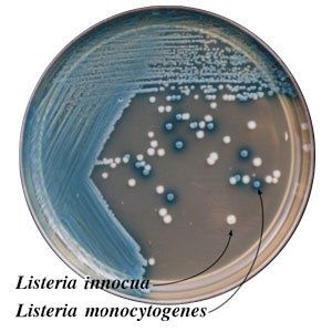 A plate of listeria innocua listeria monocytogenes