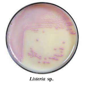 A petri dish with a pink and white colored substance that says listeria sp.