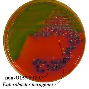 A close up of a petri dish with a label that says non-0157-stec enterobacter aerogenes
