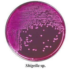 A plate of shigella sp. bacteria on a white background