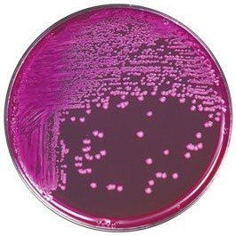 A purple plate with a lot of bacteria on it.
