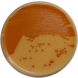 A close up of a petri dish filled with orange liquid.