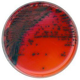 A petri dish filled with red liquid and bacteria on a white background.