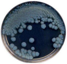A petri dish filled with bacteria on a black background.