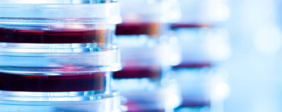 A row of petri dishes filled with red liquid in a laboratory.
