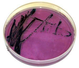 A petri dish filled with purple liquid and black bacteria