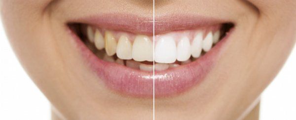cosmetic dentist chesterfield mi cosmetic dentist chesterfield mi