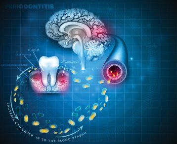 Gum disease health effects