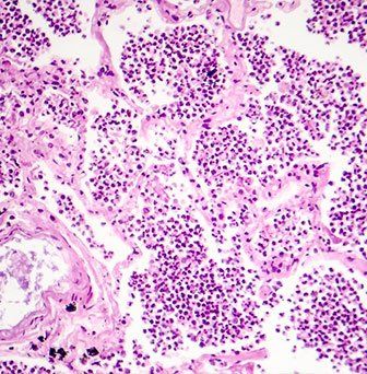 Pathologist with patient — Immunopathology in Chattanooga, TN Pathologist with patient — Immunopathology in Chattanooga, TN
