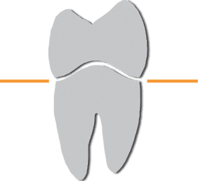 Bleaching, Veneers Bensheim-Auerbach: Dr. Ralf Gerlach Zahnarzt Bensheim-Auerbach, Dr. Ralf Gerlac
