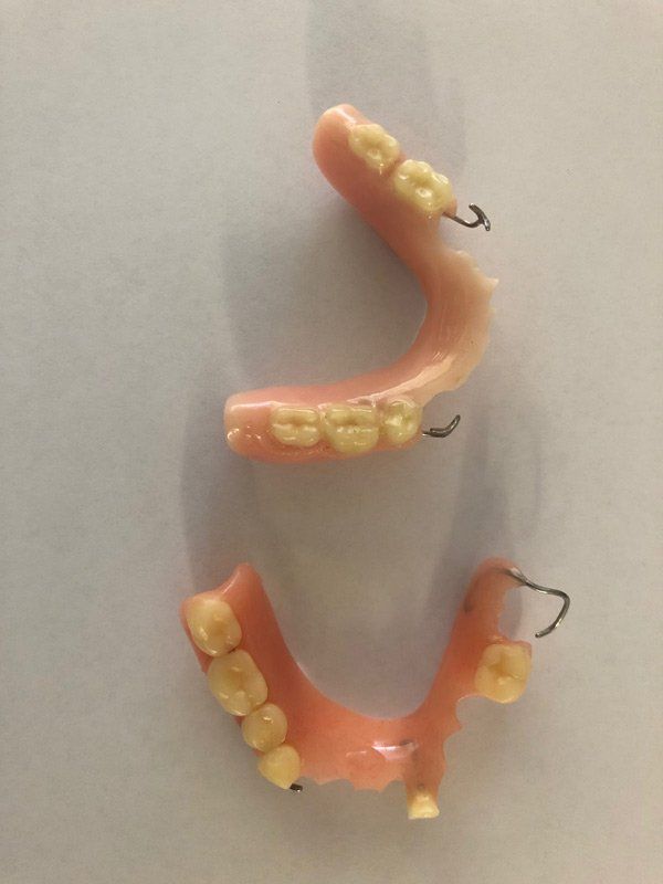 acrylic dentures