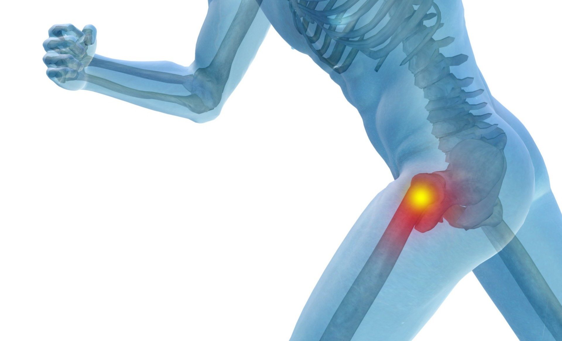 Hyaluronic Acid (HA) Injections for Hip