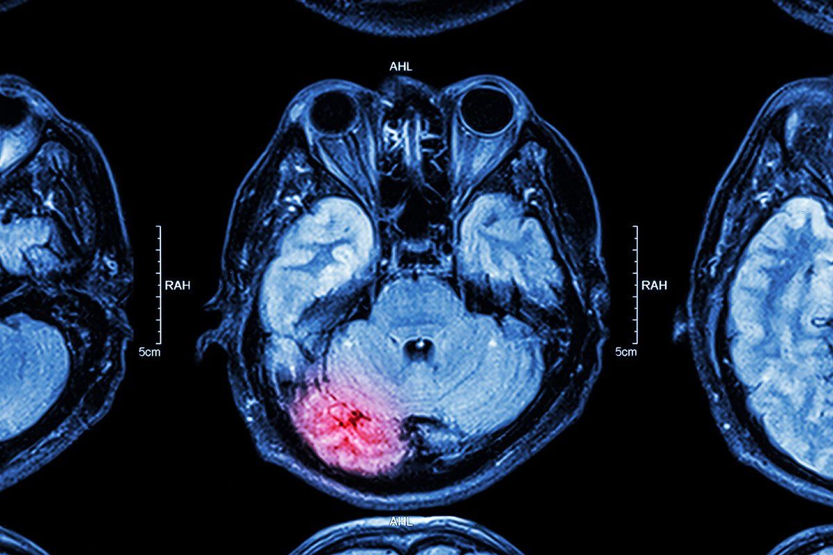 X-ray of skull