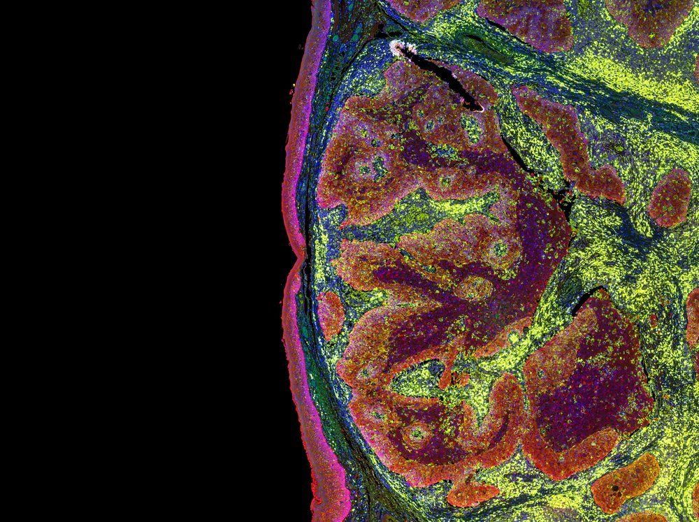 medical image of cells in a tumor sample 
