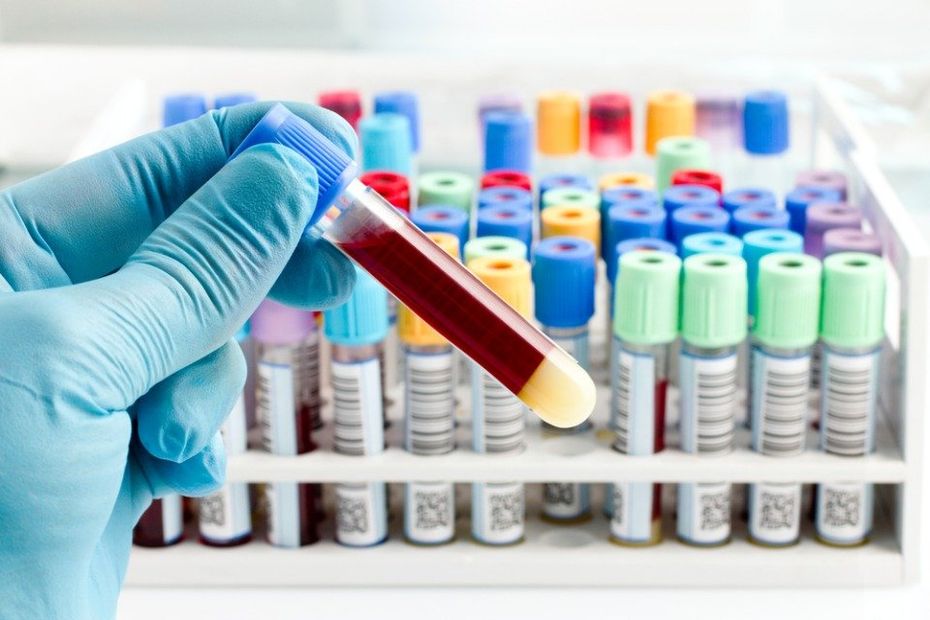 laboratorio analisi