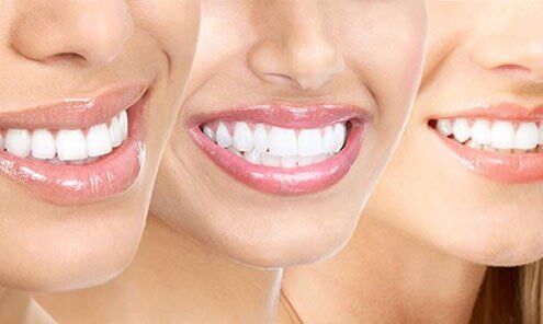 Woman Teeth - Family Dentistry in Madison, AL Woman Teeth - Family Dentistry in Madison, AL