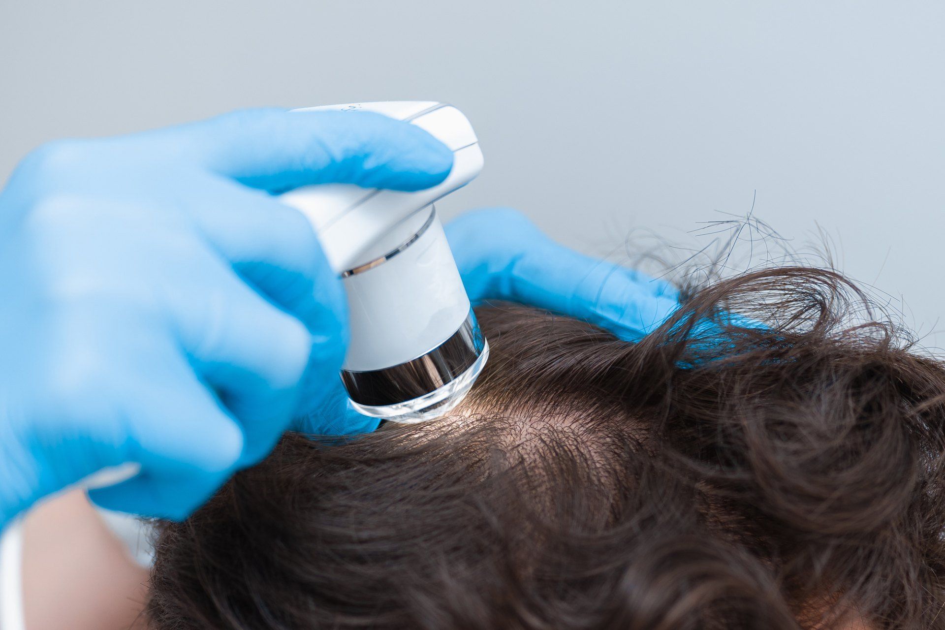 Capelli tricologia