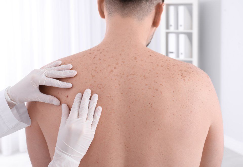 Esame dermatologico