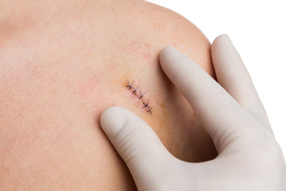 Dermatologia chirurgica
