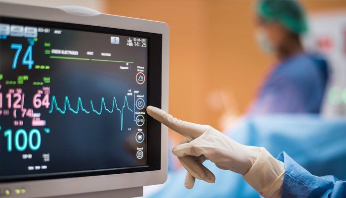 ecg