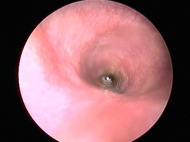 Ear Flush Treatment - Animal Hospital in Rahway, NJ