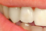 Teeth