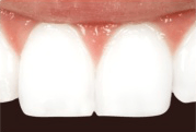 Cosmetic