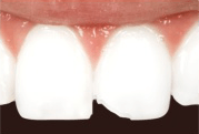 Cosmetic