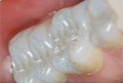 Tooth