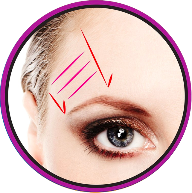 Eyebrow Lift procedure offered by Hot Springs Surgery and Vein in Hot Springs, AR Eyebrow Lift procedure offered by Hot Springs Surgery and Vein in Hot Springs, AR