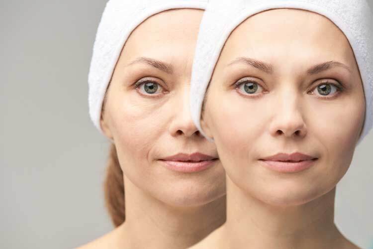 Pretty mature girl Before and after portrait Anti wrinkle healthy therapy Black circle under eyes Collagen cream Cosmetology rejuvenation