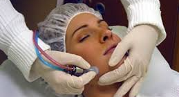 Hot Springs Surgery and Vein performing Microdermabrasion on female client