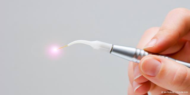 Laser-Zahnmedizin Fürth gegen Entzündungen, Herpes und Aphthen