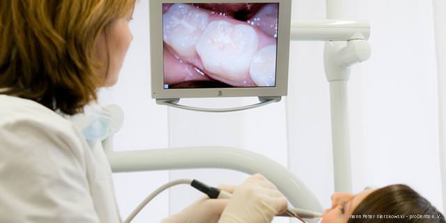 Intraoral-Kamera: Vergrößerter Blick in den Mund Intraoral-Kamera: Vergrößerter Blick in den Mund