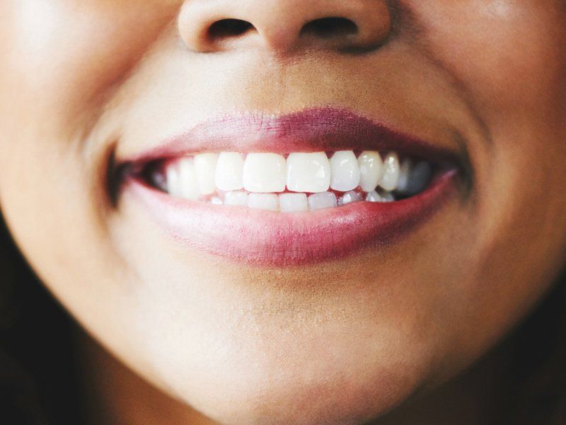 close up of white teeth