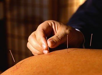 Acupuncture Process — Acupuncture Treatments in Pennsylvania Acupuncture Process — Acupuncture Treatments in Pennsylvania