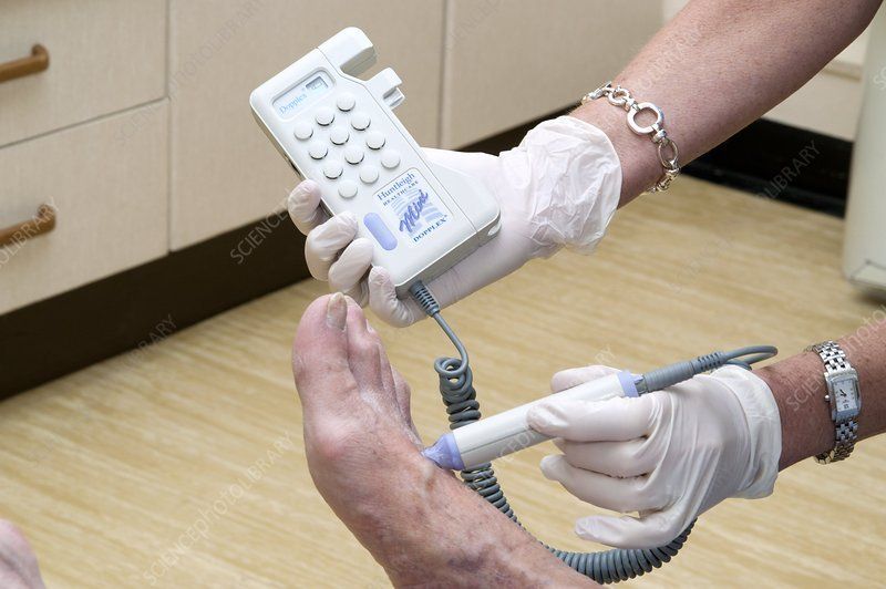 diabetes assessment