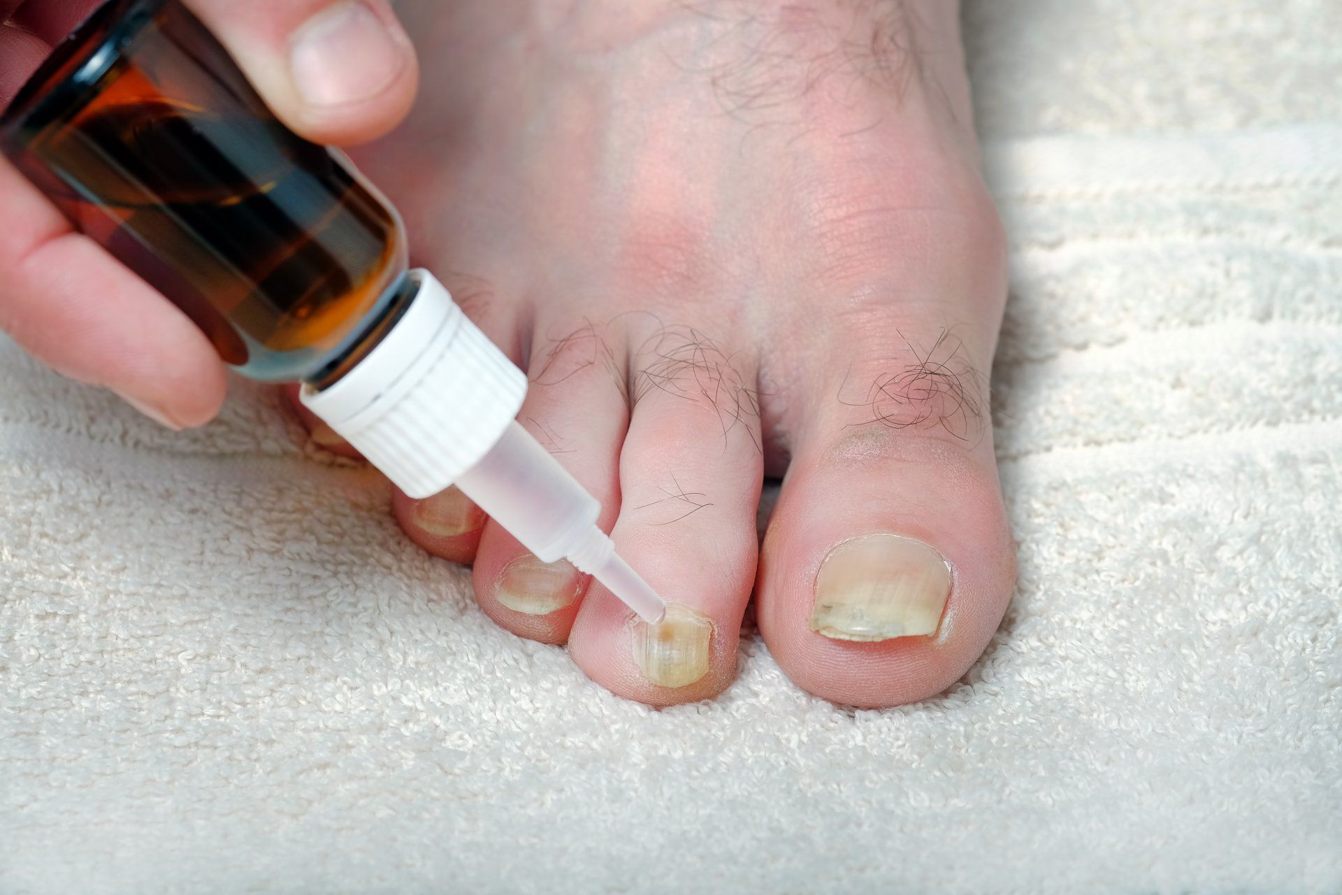 nail problems treatment