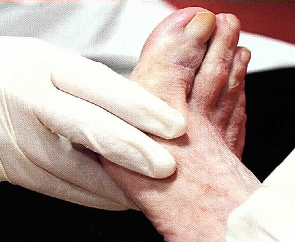 arthritis treatment services