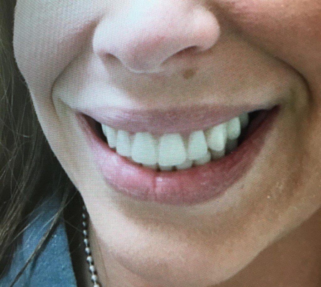 Close-up of a smiling mouth with visible teeth and a necklace at the neckline