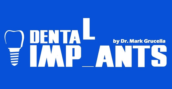 White dental implant logo and text on a blue background, with a tooth icon and “by Dr. Mark Grucella.”