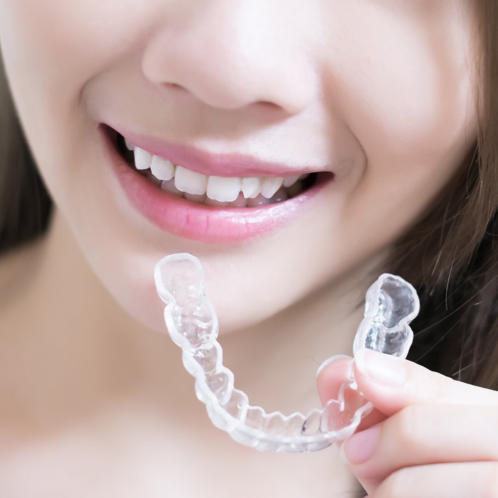 teeth straightening options