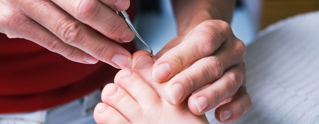 nail surgery